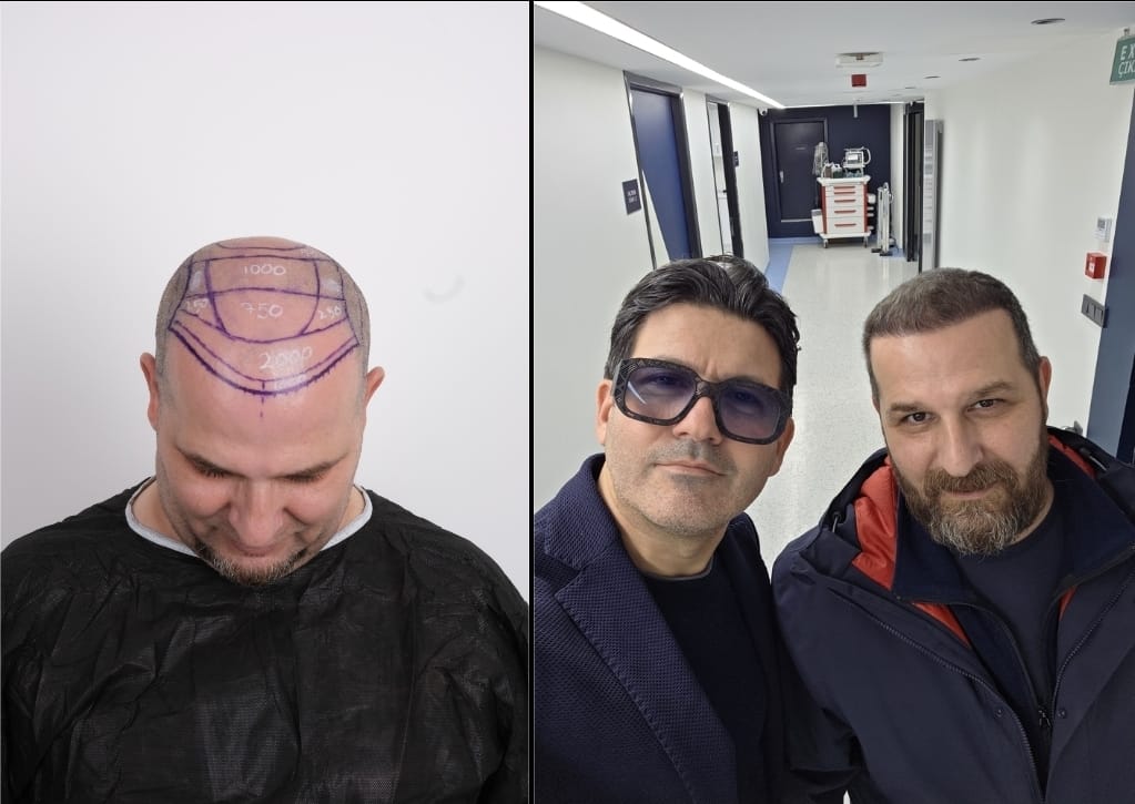 Paziente 1