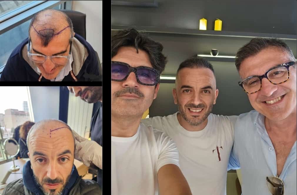 Risultato Prima e Dopo completo