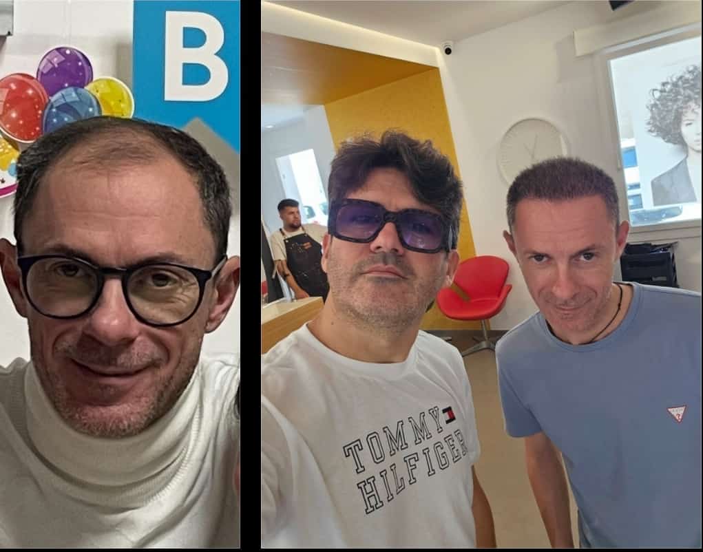 Risultato Prima e Dopo generale