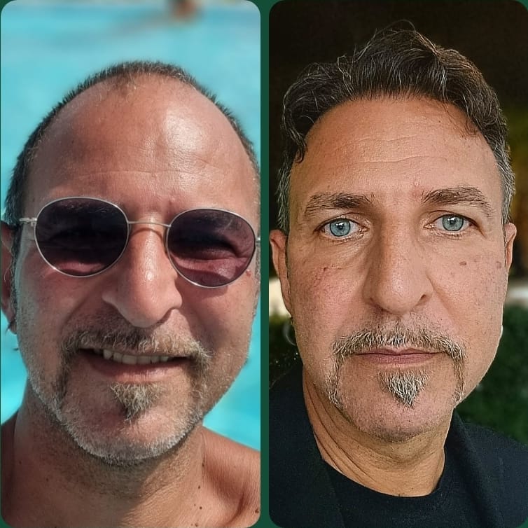 Risultato Prima e Dopo