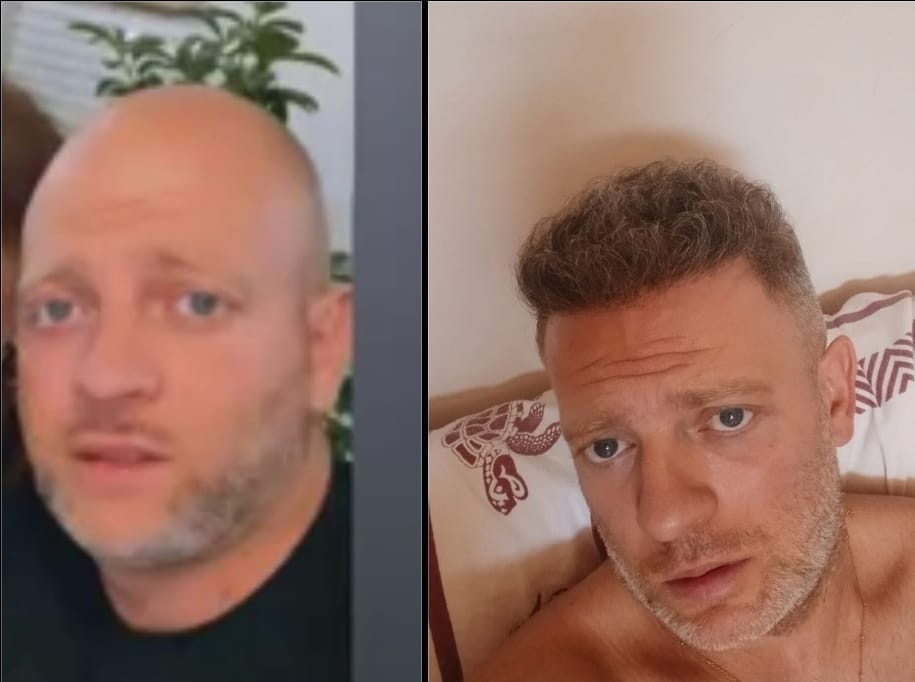 Risultato Prima e Dopo