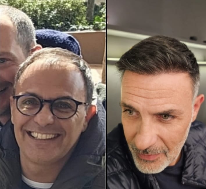 Paziente 4